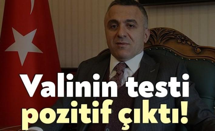 Kırıklareli Vali Osman Bilgin'in Koronavirüs testi pozitif çıktı. Vali Bilgin,