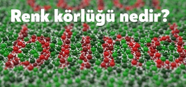 Göz Hastalıkları Uzmanı Op. Dr. Şeyda Atabay konu hakkında bilgiler