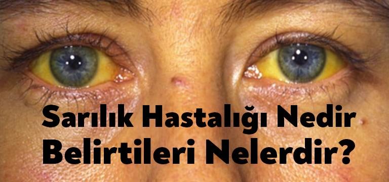 Vücutta bulunan kırmızı kan hücrelerinin yapı bozukluğuna uğramasına tıp dilinde