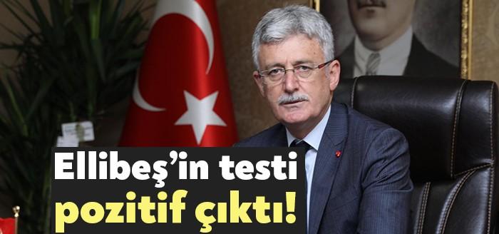 Eşi Koronavirüs'e yakalanan bu nedenle karantinaya giren AKP Kocaeli İl