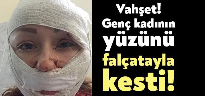 Kocaeli’de Anna Butim adlı kadın, boşanmak istediği eşinin saldırısına uğradığını