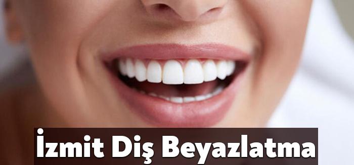 İzmit diş beyazlatma insanlar tarafından merak edilen konularında başını çekmeye