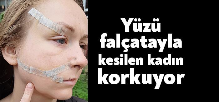 Boşanma aşamasında olduğu Mesut Öztürkmen’in (44) falçatalı saldırısına uğrayan Ukraynalı
