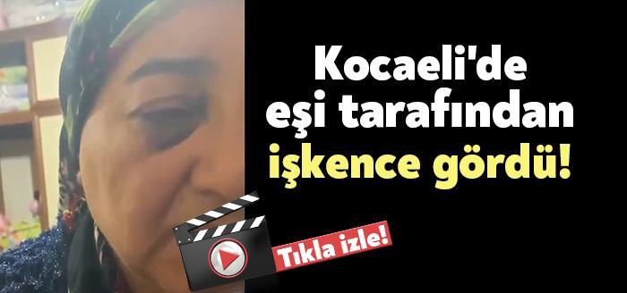 Kocaeli'nin Körfez ilçesinde bir kadının eşinden gördüğü şiddet nedeniyle ağır