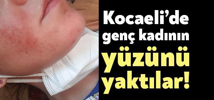Kocaeli’de genç bir kadın, yüzüne uygulanan ozon tedavi nedeniyle çok