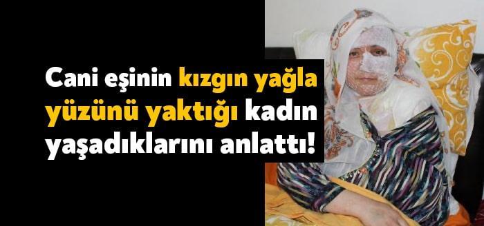 Diyarbakır'da çocuklarının gözü önünde eşi tarafından yüzünde kızgın yağ atılan