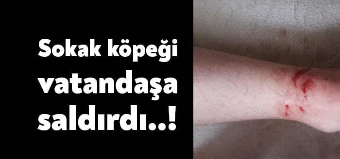 Kocaeli’nin Kandıra ilçesinde başıboş gezen bir sokak köpeği vatandaşa saldırdı.