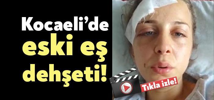 Kocaeli’de eski eşi tarafından saatlerce işkenceye maruz kaldığını iddia eden
