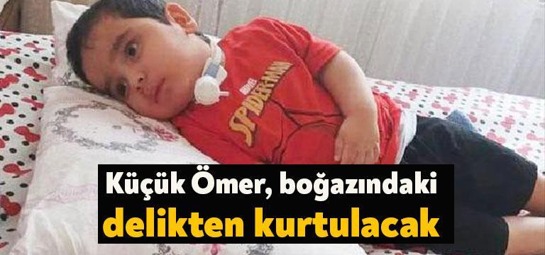 Kocaeli'nin Darıca ilçesinde yaklaşık 20 ay önce leblebinin boğazını tıkaması