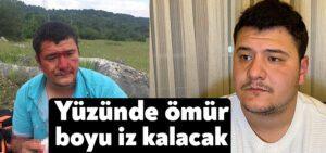 Lütfü Türkkan’ın adamlarının darp ettiği muhabirin yüzündeki iz bir ömür kalacak