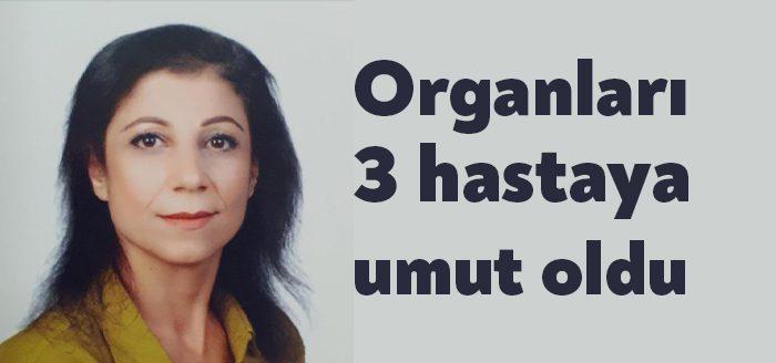 Kocaeli'de 29 Aralık 2021 tarihinde hastaneye kaldırılan Arzu Yiğit'in beyin