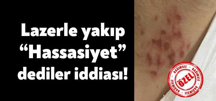 Özel İlgi Çocuk Tıp Merkezi’nde lazer epilasyon olduğunu ve cildinin
