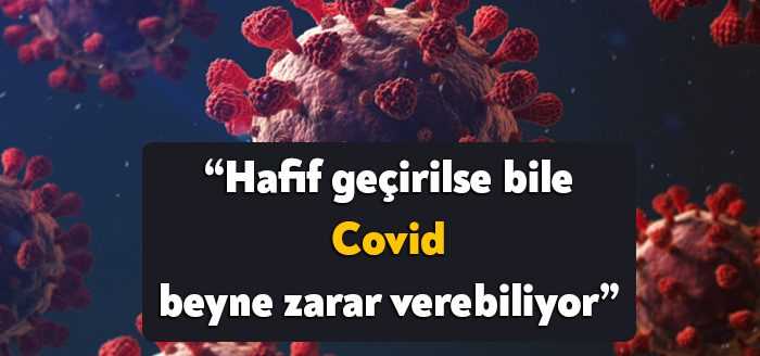 Yeni bir çalışma, hafif bir Covid durumunun bile kalıcı beyin