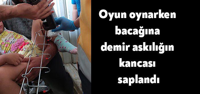 Kocaeli'de oyun oynarken bacağına demir askılığın kancası saplanan 5 yaşındaki