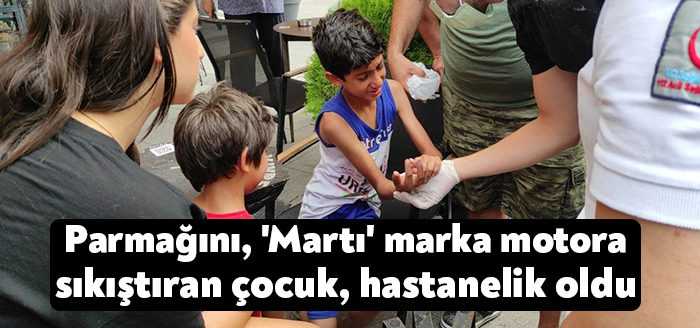 Kocaeli’nin İzmit ilçesinde parmağını 'Martı' marka elektrikli bisiklet zincirine sıkıştıran