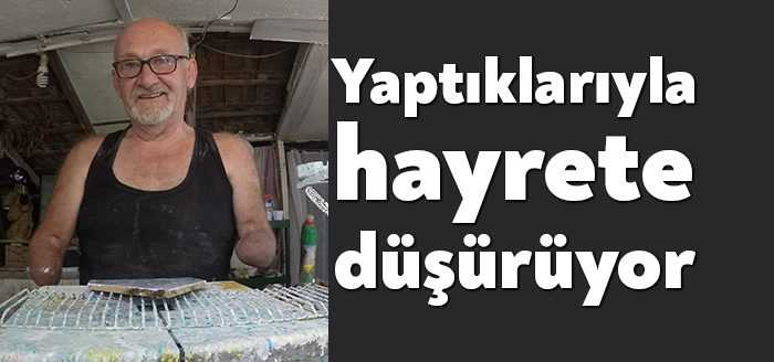 14 yaşında elektrik akımına kapılması sebebiyle iki kolu ve bir