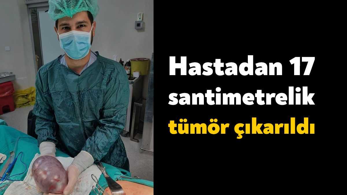 Kocaeli'nin Gölcük ilçesinde yumurtalık kanserine yakalanan 45 yaşındaki hastadan 17