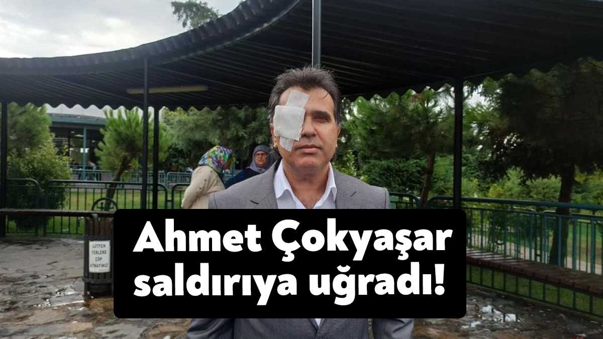 Kocaeli’nin İzmit ilçesinde restoran çıkışı saldırıya uğrayan Romanlar Konfederasyonu Genel