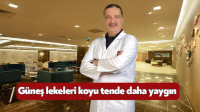 Güneş lekesinin yüksek ultraviyole radyasyonun olduğu bölgelerde yaşayan koyu ten