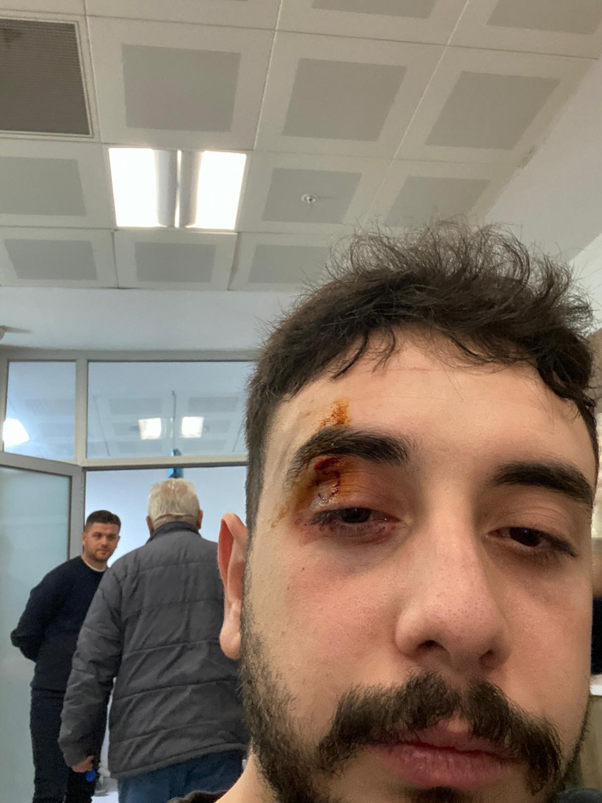 Golcuklu sporculara cirkin saldiri 3 sporcu yaralandi6