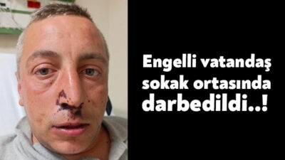 Kocaeli'nin İzmit ilçesinde engelli vatandaşın sokakta yürüdüğü sırada kimliği belirsiz