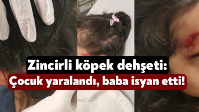 Derince’de 19 Mayıs’ta akşam saatlerinde 8 yaşındaki bir çocuğu köpek