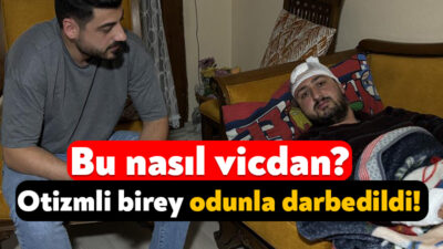 Kocaeli'nin İzmit ilçesinde yüzde 85 otizmli ve epilepsi hastası