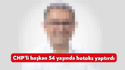 Derince Belediye Başkanı Sertif Gökçe 54 yaşında botoks yaptırdı. Kaşlarını